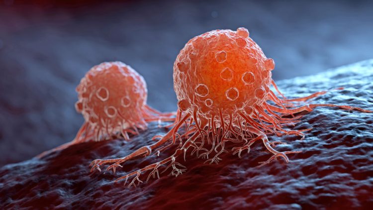 Necesario hablar de prevención y de diagnóstico oportuno del cáncer, especialistas