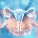 Prevén futuro alentador en terapias para cáncer de endometrio