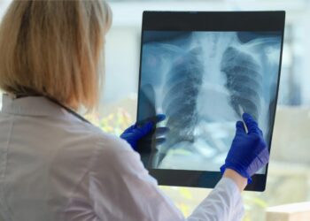 Fibrosis Pulmonar Idiopática y Esclerosis Sistémica: enfermedades raras y asfixiantes