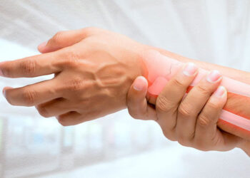 Innovación científica de UCB dentro de la reumatología en México