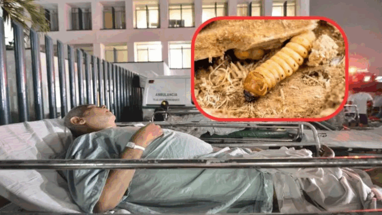 Suman cuatro casos de miasis por gusano barrenador en humanos en México