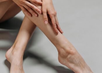 La insuficiencia venosa crónica en México representa un desafío para la salud pública