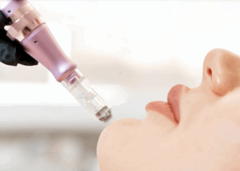 La revolución en el cuidado de la piel: Derma Pen, el secreto para una piel radiante