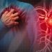 Controlar 5 factores de riesgo reduce las muertes por enfermedades cardiovasculares