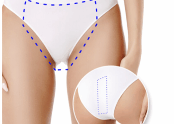 Kopay: depilación láser de barba, axilas y bikini en tendencia