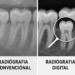 Dentistas digitales en México: planificación 3D para implantes más precisos y mejor diagnóstico